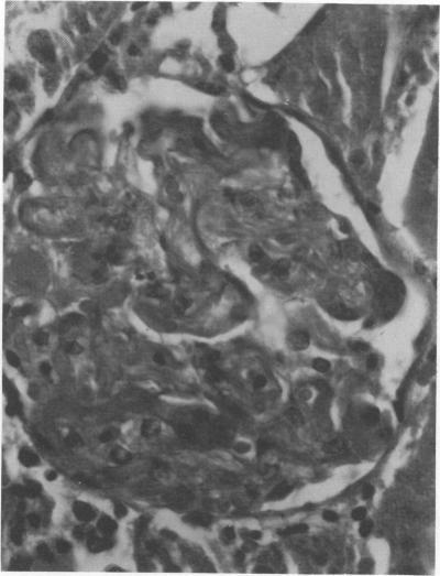 https://cdn.ncbi.nlm.nih.gov/pmc/blobs/c504/415073/2e5cd19ba908/iai00230-0163-a.jpg