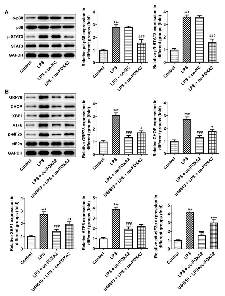 https://cdn.ncbi.nlm.nih.gov/pmc/blobs/c505/10469380/69bc2287b73c/etm-26-04-12168-g03.jpg