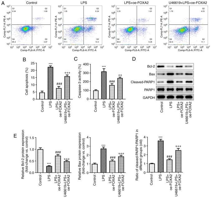 https://cdn.ncbi.nlm.nih.gov/pmc/blobs/c505/10469380/770688daa5f7/etm-26-04-12168-g05.jpg