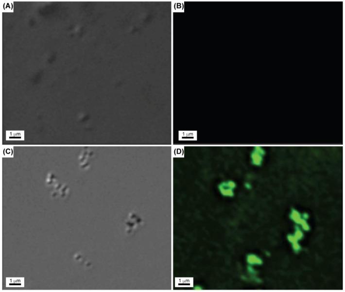 https://cdn.ncbi.nlm.nih.gov/pmc/blobs/c508/6209258/911ed257aef2/gels-04-00028-g007.jpg