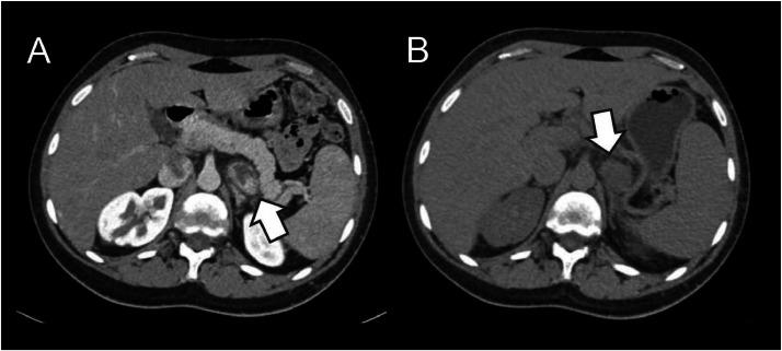 https://cdn.ncbi.nlm.nih.gov/pmc/blobs/c512/11625116/a6d9307d466a/gr3.jpg