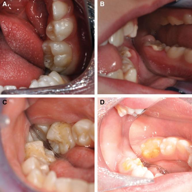 https://cdn.ncbi.nlm.nih.gov/pmc/blobs/c517/4977140/6617f5e54568/gox-4-e812-g007.jpg