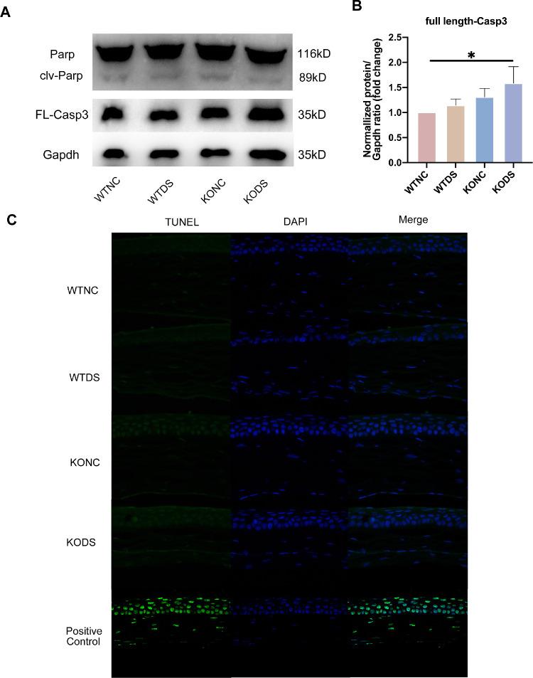 https://cdn.ncbi.nlm.nih.gov/pmc/blobs/c519/11731164/0ea1573a1af4/iovs-66-1-24-f004.jpg