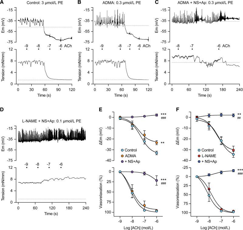 https://cdn.ncbi.nlm.nih.gov/pmc/blobs/c51c/10956675/d34a2ded0548/hyp-81-764-g002.jpg