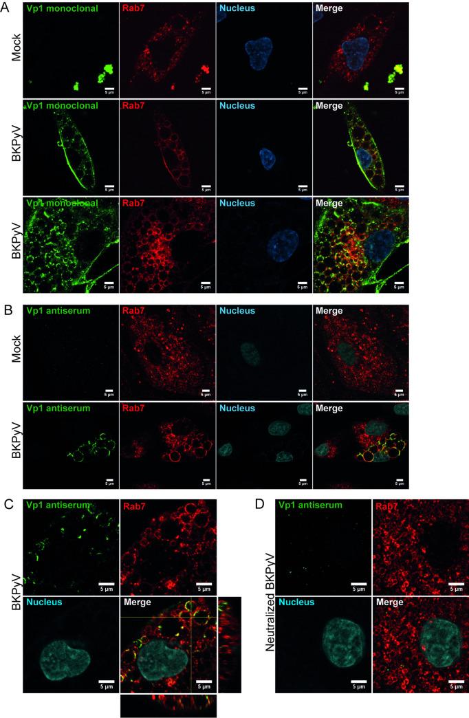 https://cdn.ncbi.nlm.nih.gov/pmc/blobs/c51c/11581322/5f482b563e7a/ppat.1012681.g006.jpg