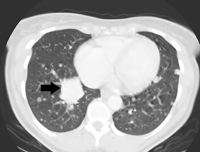 https://cdn.ncbi.nlm.nih.gov/pmc/blobs/c51c/7481490/65bdae74ee95/gr3.jpg