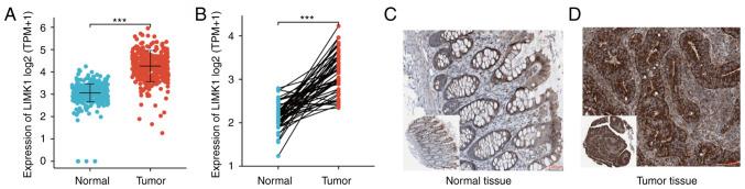 https://cdn.ncbi.nlm.nih.gov/pmc/blobs/c51c/9185146/7374e3936173/ol-24-01-13354-g02.jpg