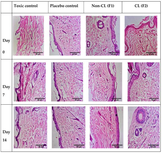 https://cdn.ncbi.nlm.nih.gov/pmc/blobs/c524/8875374/38ce674b59e5/pharmaceutics-14-00273-g015.jpg