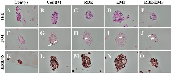 https://cdn.ncbi.nlm.nih.gov/pmc/blobs/c52a/6283238/a5e8c1f55a05/BEM-39-595-g006.jpg