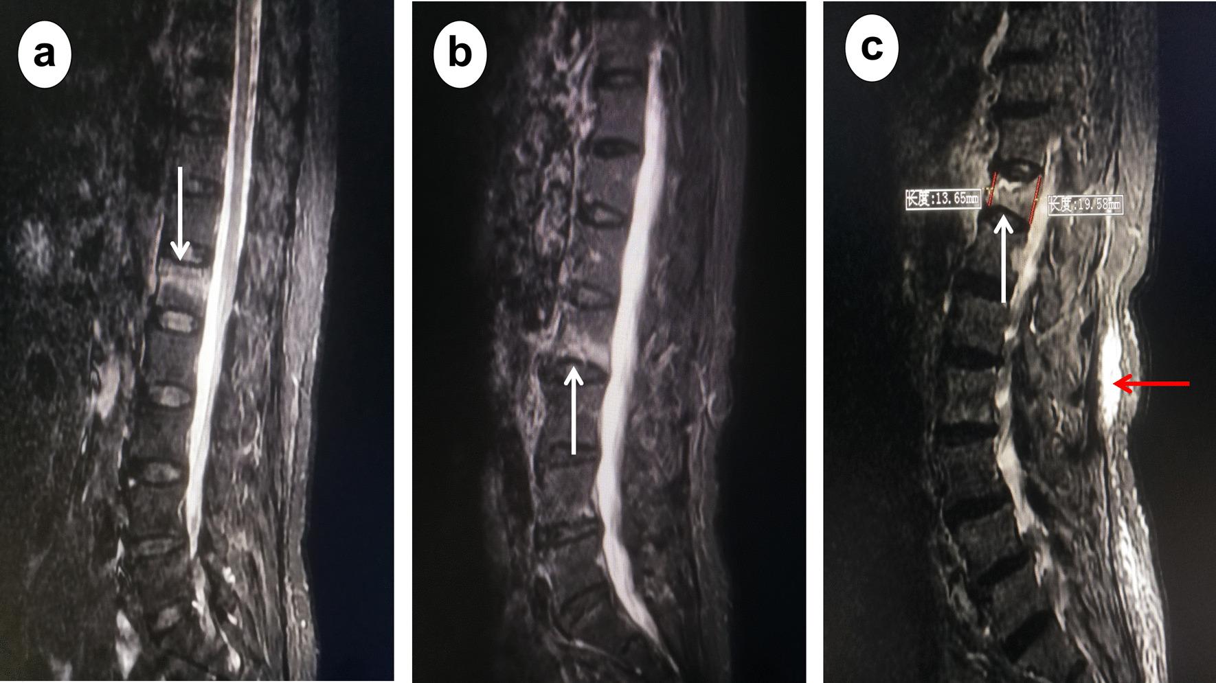 https://cdn.ncbi.nlm.nih.gov/pmc/blobs/c531/10469467/dddfe216b6e1/13018_2023_4140_Fig1_HTML.jpg