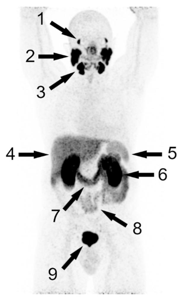 https://cdn.ncbi.nlm.nih.gov/pmc/blobs/c535/9367536/84e57cd0e967/cancers-14-03638-g001.jpg