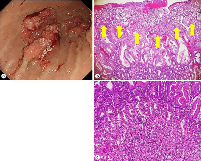 https://cdn.ncbi.nlm.nih.gov/pmc/blobs/c53a/7989726/e7778ae7f699/crg-0015-0202-g02.jpg