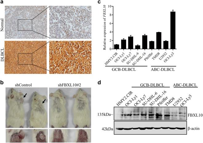 https://cdn.ncbi.nlm.nih.gov/pmc/blobs/c53c/5833345/392d0f883f37/41419_2017_66_Fig1_HTML.jpg
