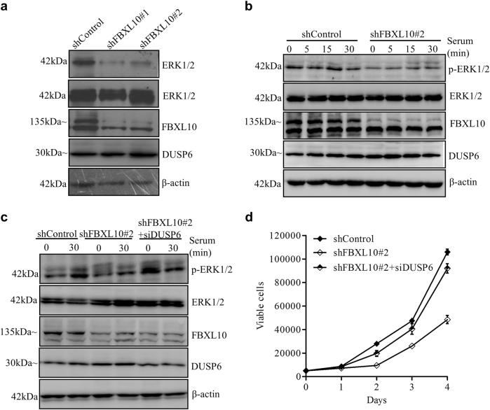 https://cdn.ncbi.nlm.nih.gov/pmc/blobs/c53c/5833345/8e6084a844b4/41419_2017_66_Fig6_HTML.jpg