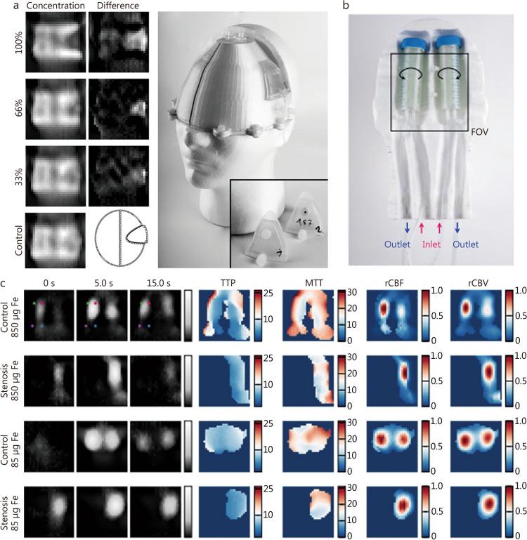 https://cdn.ncbi.nlm.nih.gov/pmc/blobs/c546/12034128/64a9127e20b9/40779_2025_603_Fig7_HTML.jpg