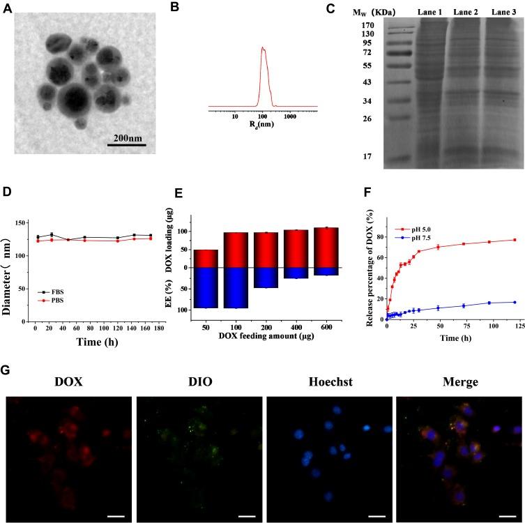 https://cdn.ncbi.nlm.nih.gov/pmc/blobs/c546/7185325/c6e1b5ef1dcf/IJN-15-2873-g0002.jpg