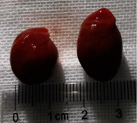 https://cdn.ncbi.nlm.nih.gov/pmc/blobs/c549/9581619/7e829077d811/DM2022-4412228.003.jpg