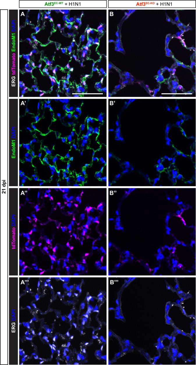 https://cdn.ncbi.nlm.nih.gov/pmc/blobs/c54c/10219650/6fd8b646eb1b/elife-83835-fig5-figsupp1.jpg