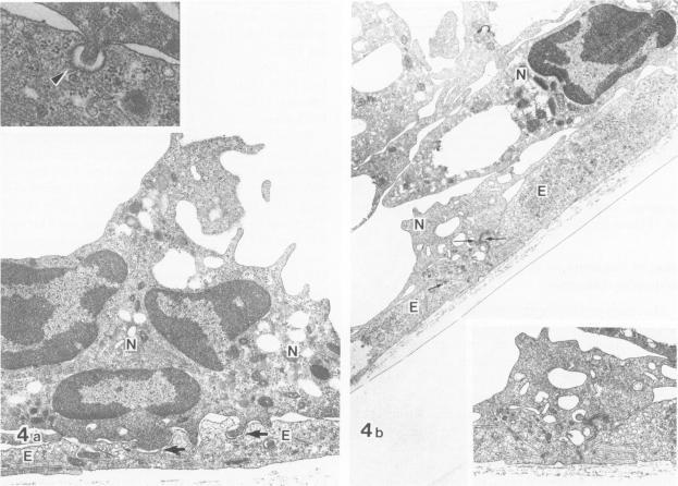 https://cdn.ncbi.nlm.nih.gov/pmc/blobs/c54d/1888238/ed3941c988ee/amjpathol00152-0163-a.jpg
