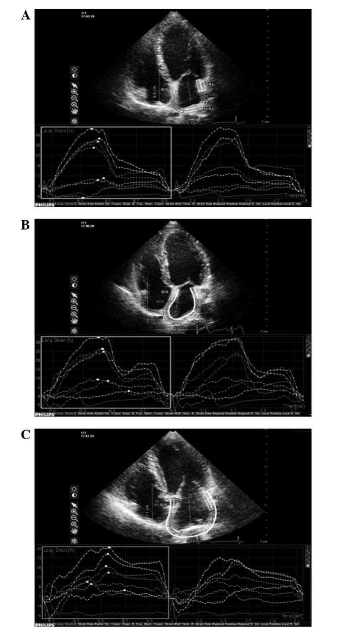 https://cdn.ncbi.nlm.nih.gov/pmc/blobs/c556/3524256/465f93879749/ETM-05-01-0243-g00.jpg