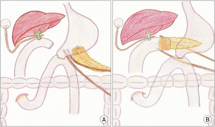 https://cdn.ncbi.nlm.nih.gov/pmc/blobs/c55a/4751147/1026eb5f6f30/astr-90-64-g003.jpg