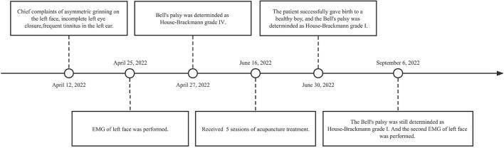 https://cdn.ncbi.nlm.nih.gov/pmc/blobs/c55f/9845618/63a679d08c81/fneur-13-1088138-g0001.jpg