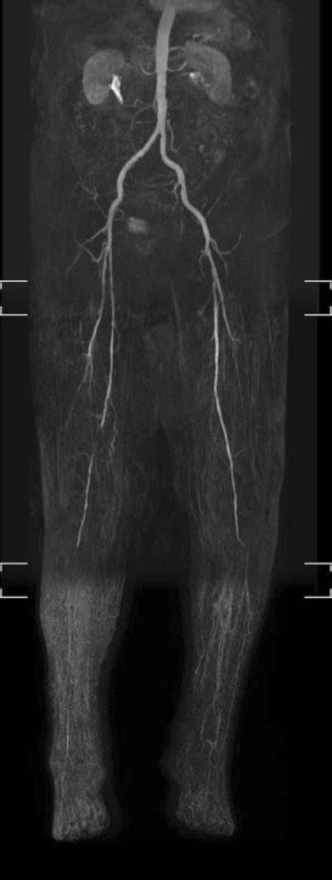 https://cdn.ncbi.nlm.nih.gov/pmc/blobs/c56a/7875854/3ce795d2ac4d/104_2020_1313_Fig6_HTML.jpg