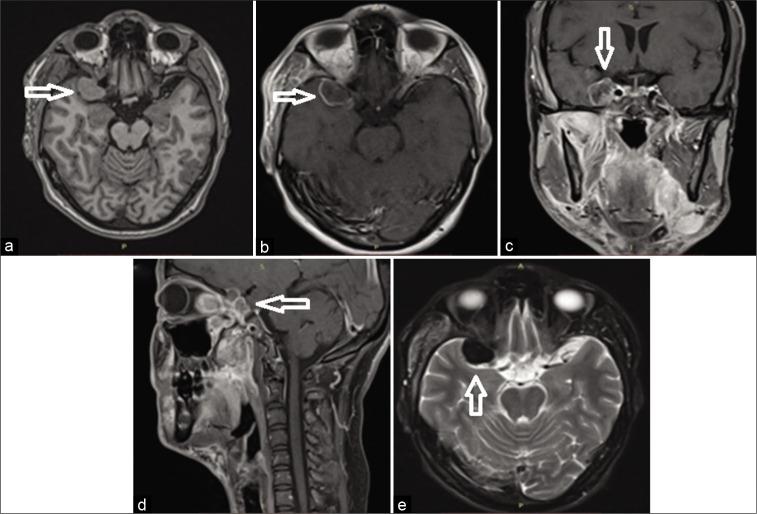 https://cdn.ncbi.nlm.nih.gov/pmc/blobs/c56d/9168305/5a113dfe31cb/SNI-13-224-g001.jpg