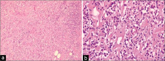 https://cdn.ncbi.nlm.nih.gov/pmc/blobs/c56d/9168305/a3a75442ad83/SNI-13-224-g002.jpg