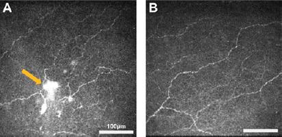 https://cdn.ncbi.nlm.nih.gov/pmc/blobs/c571/10479835/7186cd1fd518/NRR-19-140-g005.jpg