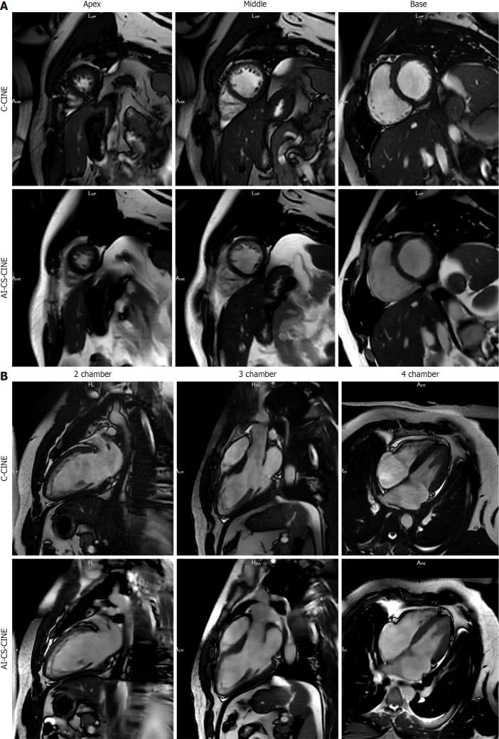 https://cdn.ncbi.nlm.nih.gov/pmc/blobs/c571/12304818/fde3f688b498/wjc-17-7-108745-g002.jpg