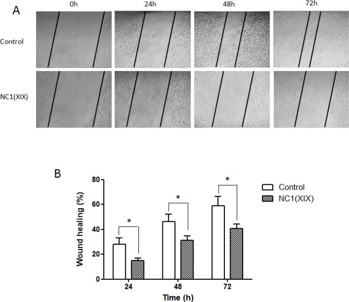 https://cdn.ncbi.nlm.nih.gov/pmc/blobs/c577/4811477/68eeb07a475b/oncotarget-07-1516-g001.jpg
