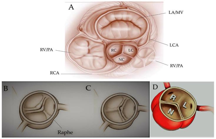 https://cdn.ncbi.nlm.nih.gov/pmc/blobs/c578/11509083/1270e0d78a2e/jcdd-11-00317-g001.jpg