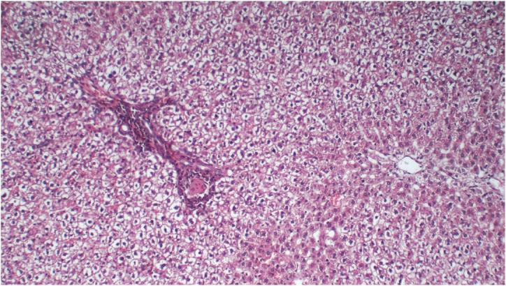 https://cdn.ncbi.nlm.nih.gov/pmc/blobs/c583/10196525/3047d143b808/gr7c.jpg