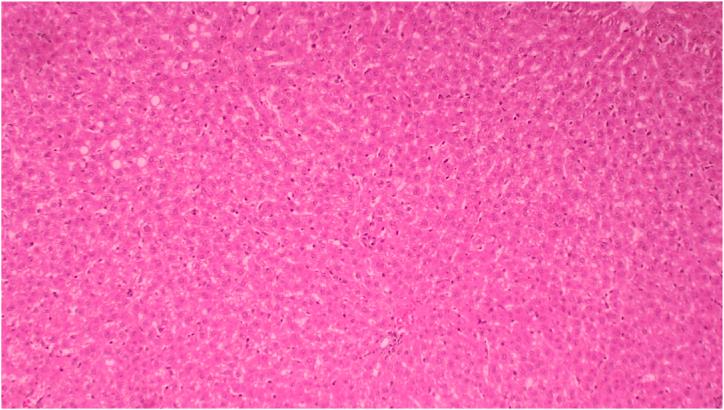 https://cdn.ncbi.nlm.nih.gov/pmc/blobs/c583/10196525/cc3a81bfd12d/gr6.jpg