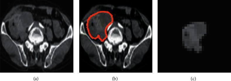 https://cdn.ncbi.nlm.nih.gov/pmc/blobs/c587/9325563/77b91ff6eea3/CMMI2022-2279018.002.jpg