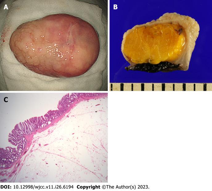 https://cdn.ncbi.nlm.nih.gov/pmc/blobs/c58c/10507559/0b4cab22035e/WJCC-11-6194-g003.jpg