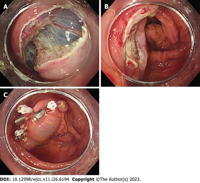 https://cdn.ncbi.nlm.nih.gov/pmc/blobs/c58c/10507559/bb770c156386/WJCC-11-6194-g002.jpg