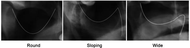 https://cdn.ncbi.nlm.nih.gov/pmc/blobs/c58e/11705095/7ac8afe38018/in_vivo-39-313-g0002.jpg