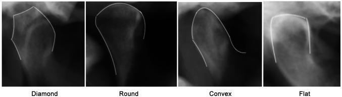 https://cdn.ncbi.nlm.nih.gov/pmc/blobs/c58e/11705095/d383f8157ccb/in_vivo-39-313-g0001.jpg