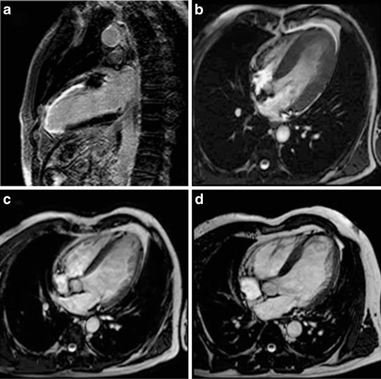 https://cdn.ncbi.nlm.nih.gov/pmc/blobs/c58e/3289007/65f42df55d15/13244_2011_101_Fig8_HTML.jpg
