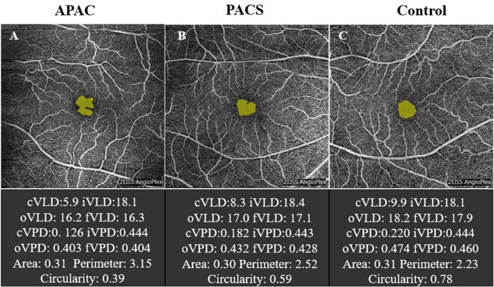https://cdn.ncbi.nlm.nih.gov/pmc/blobs/c592/7603312/4ffc84910745/41598_2020_73223_Fig3_HTML.jpg