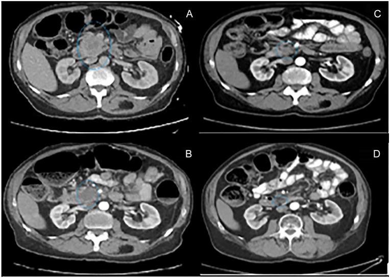https://cdn.ncbi.nlm.nih.gov/pmc/blobs/c59a/9290102/7f1ce509ce02/10.1177_23247096221111763-fig1.jpg