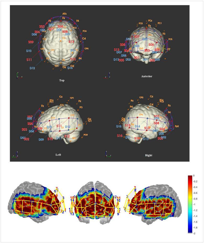 https://cdn.ncbi.nlm.nih.gov/pmc/blobs/c59e/10726898/a1a4a690bd90/BRB3-13-e3303-g004.jpg