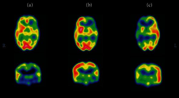 https://cdn.ncbi.nlm.nih.gov/pmc/blobs/c5a3/7953581/3c1505541684/MOI2021-6614356.002.jpg