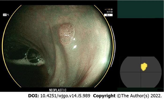 https://cdn.ncbi.nlm.nih.gov/pmc/blobs/c5a3/9124983/39758d40e8bb/WJGO-14-989-g002.jpg