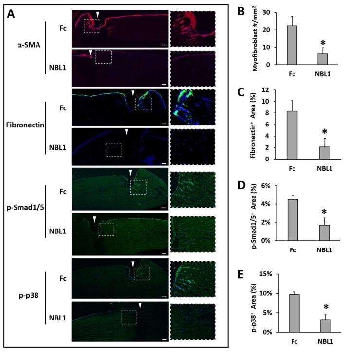 https://cdn.ncbi.nlm.nih.gov/pmc/blobs/c5a8/10669476/ad9bf49b5c31/biomolecules-13-01570-g004.jpg