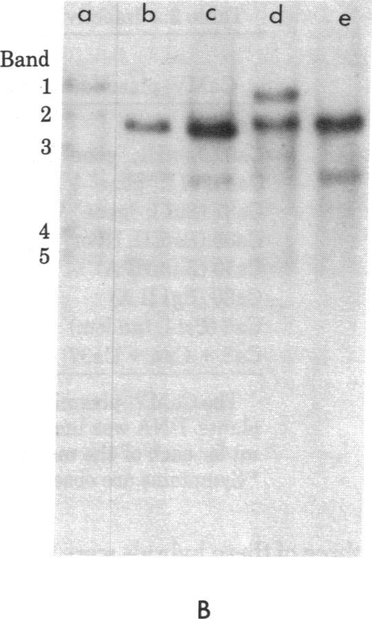 https://cdn.ncbi.nlm.nih.gov/pmc/blobs/c5ad/346322/93995cdc3080/pnas00448-0198-a.jpg