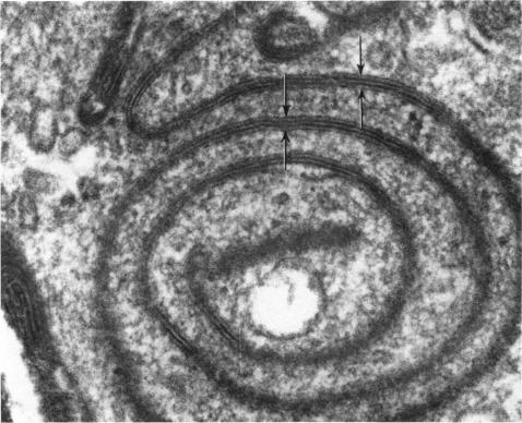https://cdn.ncbi.nlm.nih.gov/pmc/blobs/c5af/1271406/148478bd356b/janat00319-0037-a.jpg