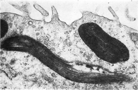 https://cdn.ncbi.nlm.nih.gov/pmc/blobs/c5af/1271406/22d0e10e05c2/janat00319-0029-b.jpg